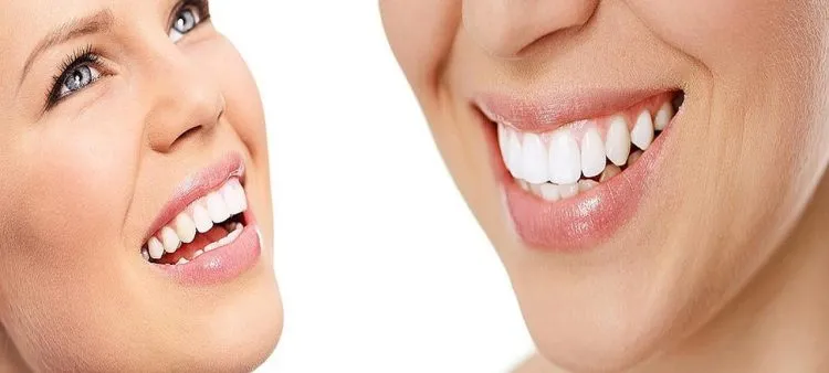 Pourquoi mettre en place une facette pelliculaire ?
