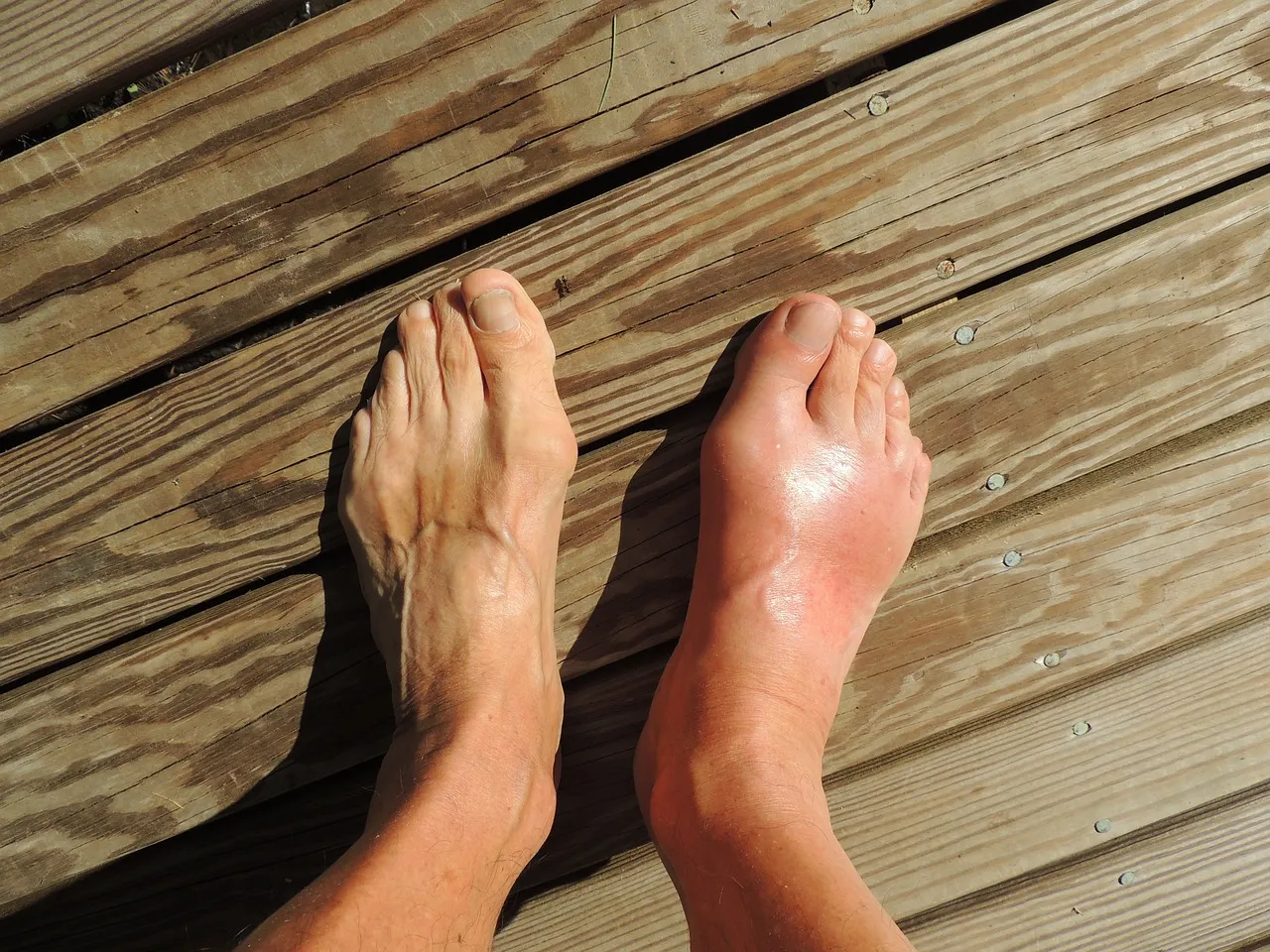 Comprendre la ligamentoplastie : un guide détaillé