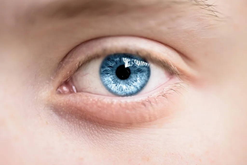 blépharoplastie