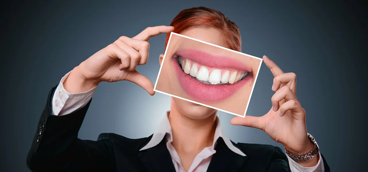 Kit de blanchiment dentaire Californian Smiles : tout ce que vous devez savoir