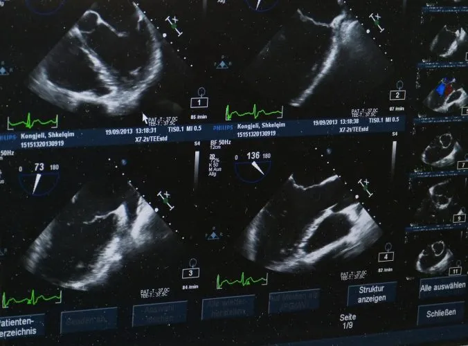 L’échographie, une révolution médicale