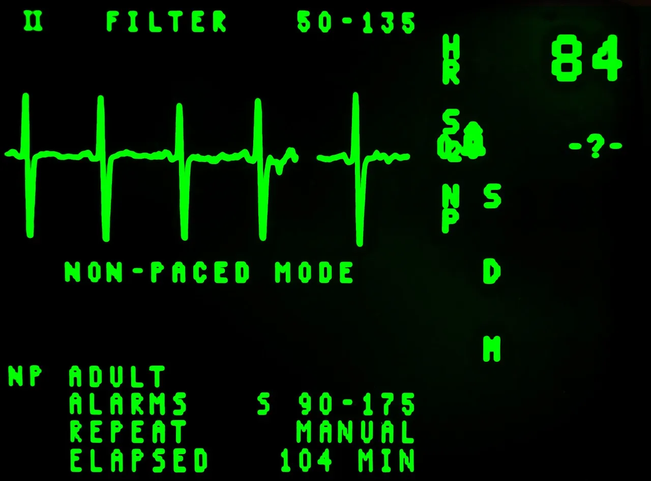 Qu’est-ce que l’ECG de repos ?